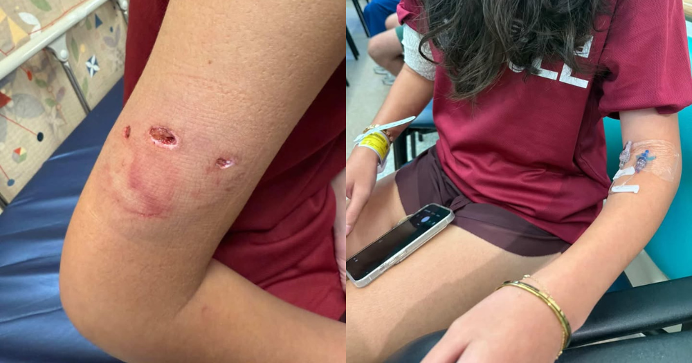 Insiden Gigitan Anjing di Lentor, Singapore