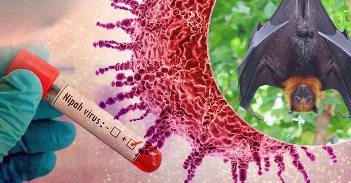 Memahami Virus Nipah